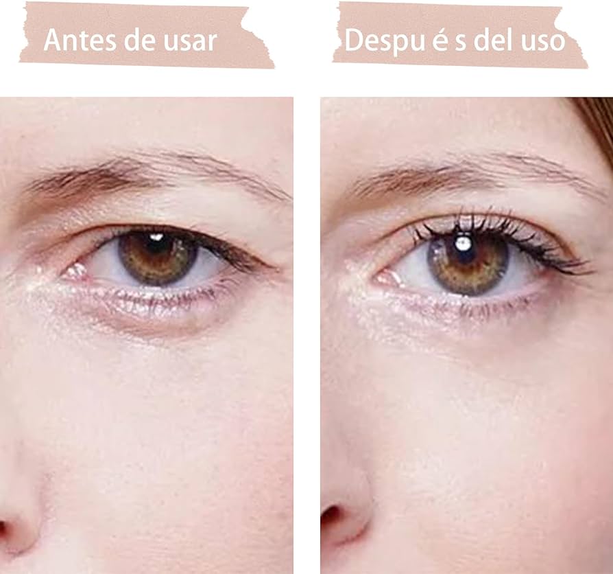 Eyelid Pushup - Cintas Levanta Párpados.