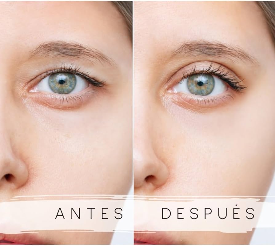 Eyelid Pushup - Cintas Levanta Párpados.