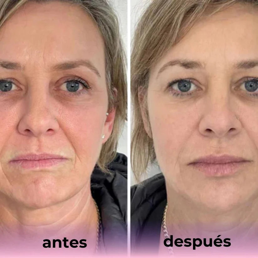 Mascarilla de Bio-Colágeno - Pack x 4 unidades