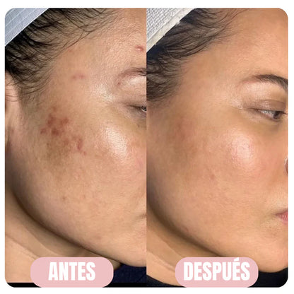 Mascarilla de Bio-Colágeno - Pack x 4 unidades