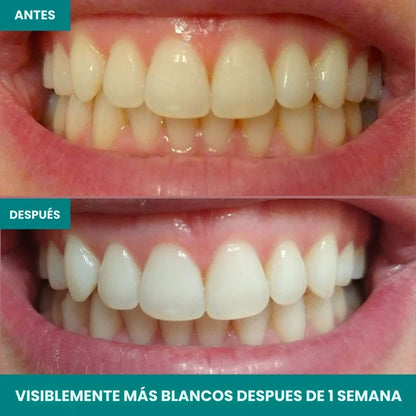 PureSmile™ Tratamiento Avanzado 2 Semanas