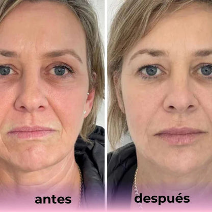 Mascarilla de Bio-Colágeno - Pack x 4 unidades